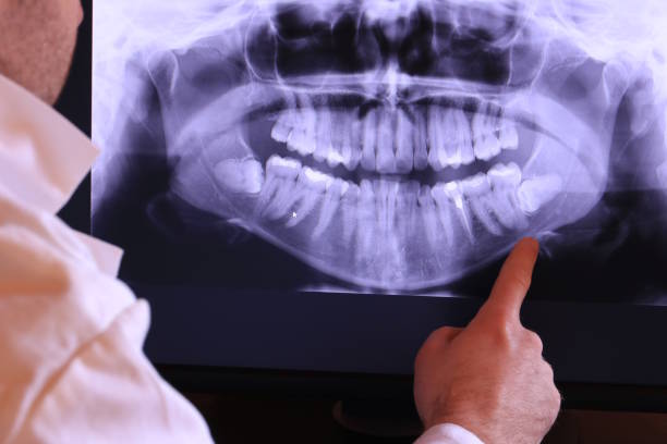 Best Knocked-Out Tooth Emergency  in , CT